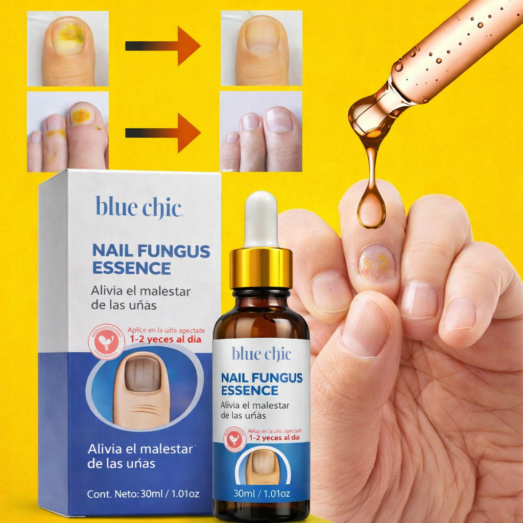 ESENCIA ANTIHONGOS PARA UÑAS BLUE CHIC L