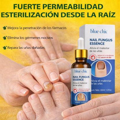 ESENCIA ANTIHONGOS PARA UÑAS BLUE CHIC L
