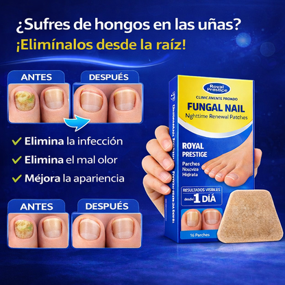 “Tratamiento nocturno para eliminar hongos en uñas”