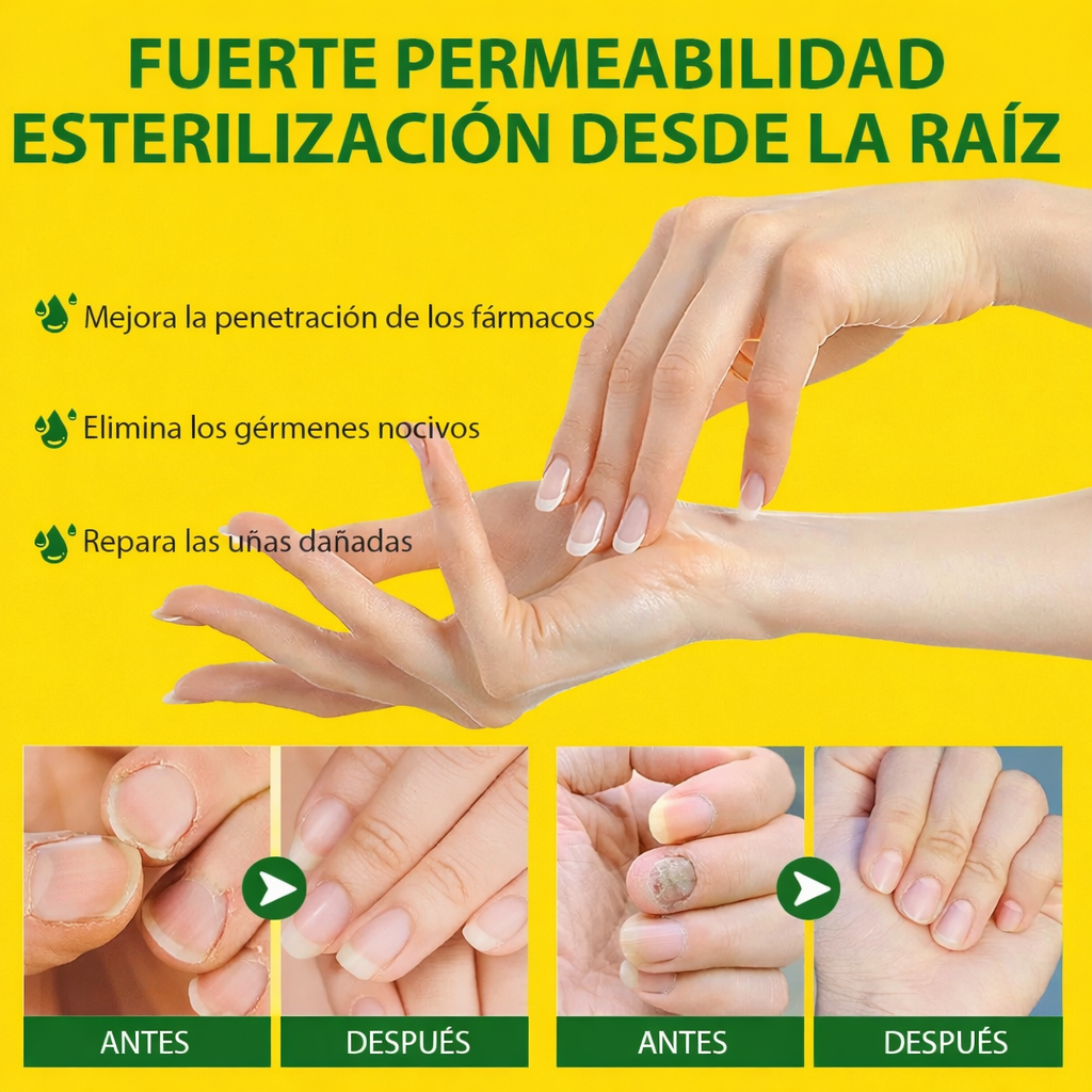 Transforma la apariencia de tus uñas, fácil, rápido y desde casa.