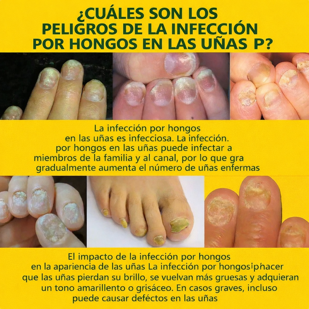ESENCIA ANTIHONGOS PARA UÑAS BLUE CHIC L