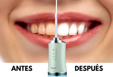 Irrigador Bucal Portátil – Limpieza Profesional en Casa, Todos los Días 🦷✨