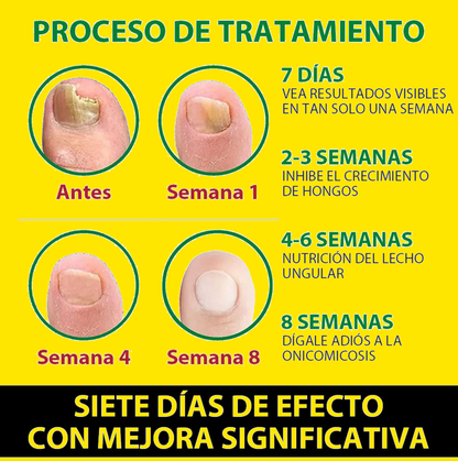 Transforma la apariencia de tus uñas, fácil, rápido y desde casa.